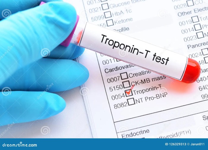 Troponin sample